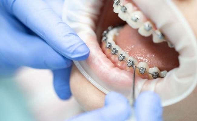 Orthodontic-Treatment-30.jpg